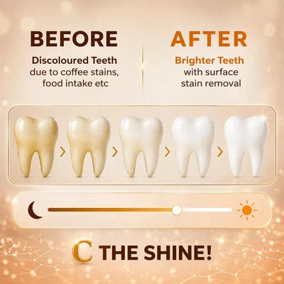 Toothpaste Advance | Whitamin Vit C (Whitening)-Vegan, & Cruelty Free - Vitamin C, 5% Nano Hydroxyapatite, Enamel Repair- Glycerin Free, Fluoride Free & No Added Artificial Colors - Bentodent - 100gm