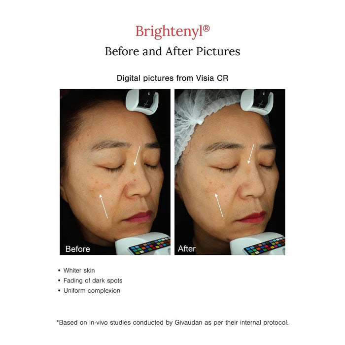 Face Serum | 2% Alpha Arbutin + D-Gallic Acid Natural Face Serum - Serum For Dark Spots & Hyperpigmentation- Fortified with Rice & Licorice - Cruelty Free & Vegan, Dermatologically Tested - Juicy Chemistry - 30ml