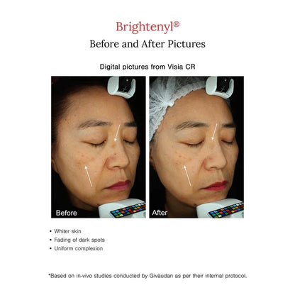 Face Serum | 2% Alpha Arbutin + D-Gallic Acid Natural Face Serum - Serum For Dark Spots &amp; Hyperpigmentation- Fortified with Rice &amp; Licorice  - Cruelty Free &amp; Vegan, Dermatologically Tested - Juicy Chemistry - 30ml