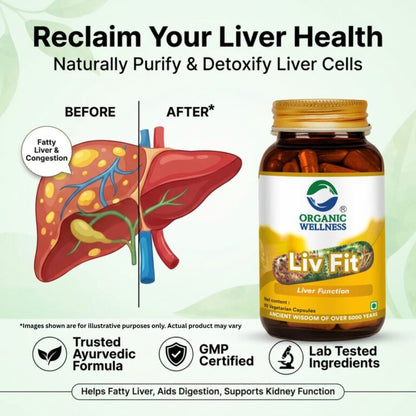 Health Supplements | Liv Fit (Liver Function) -Detox &amp; Repair Fatty Liver Formula ,Healthy Liver -No Artificial Additives- Organic Wellness - 90 Vegetarian Capsules